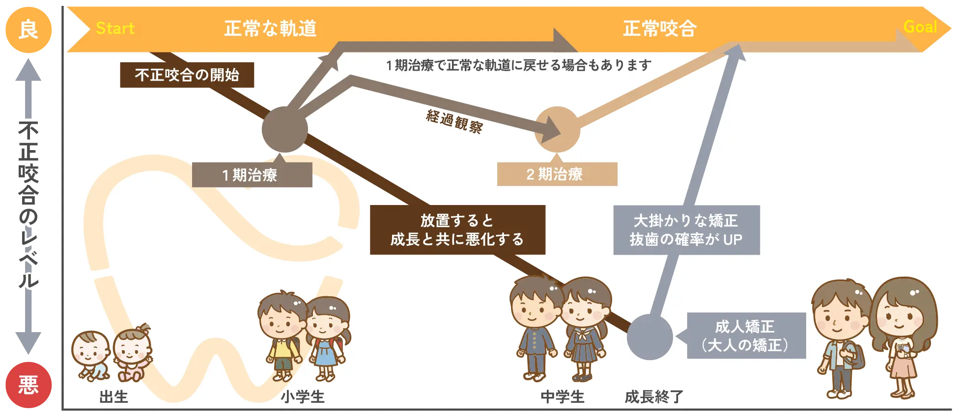 小児矯正歯科の治療の流れ