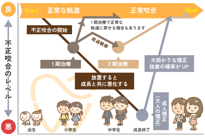 小児矯正歯科の治療の流れ