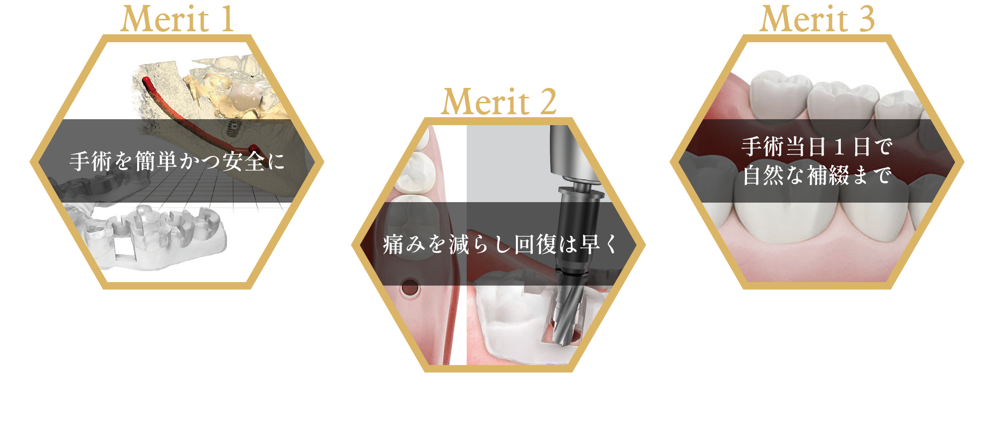 オステムワンガイドの特長