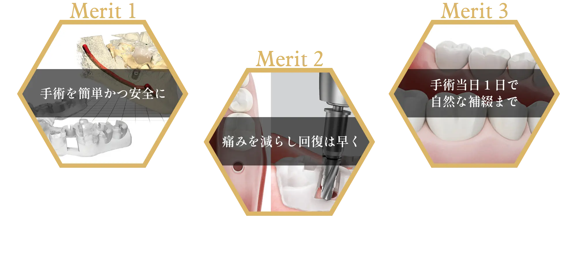 オステムワンガイドの特長