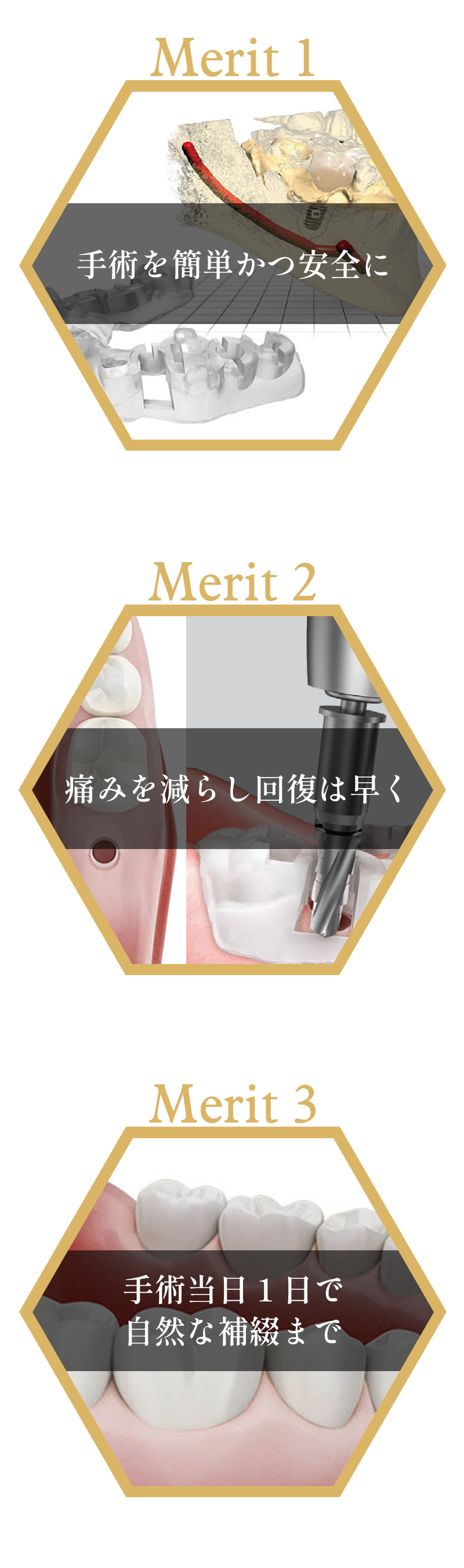 オステムワンガイドの特長