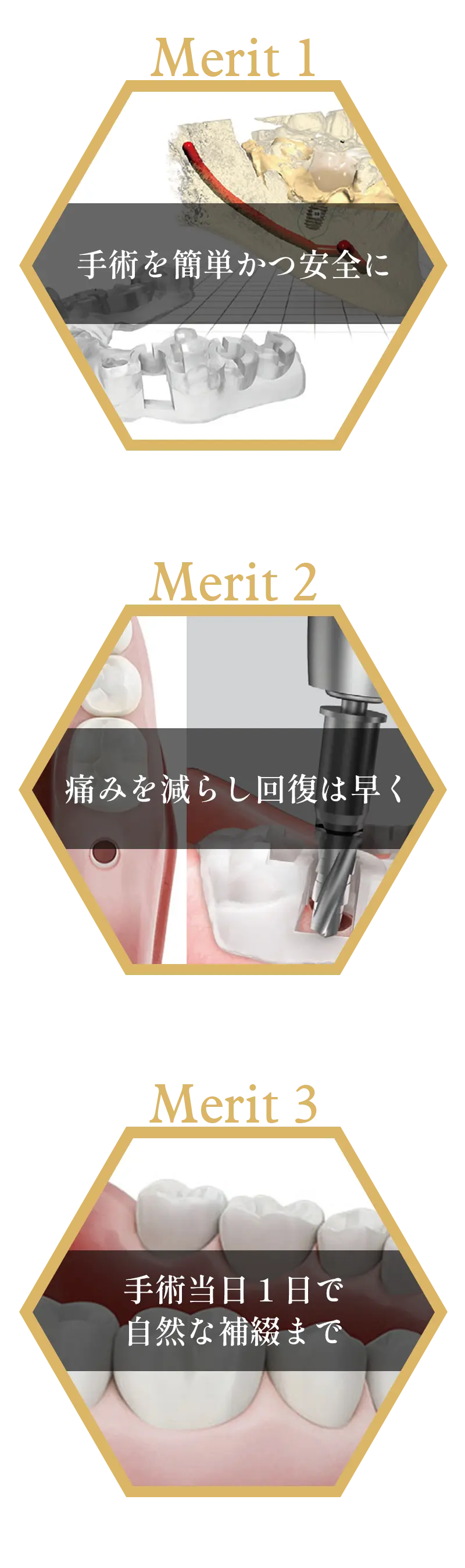 オステムワンガイドの特長