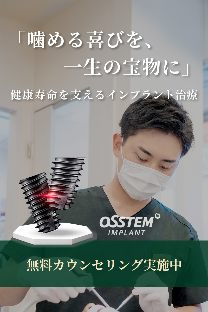 インプラント無料カウンセリング実施中