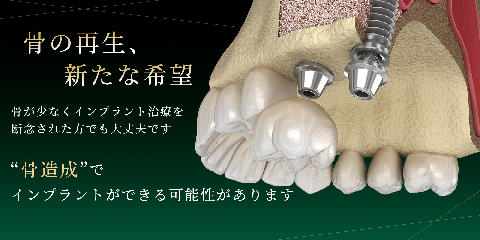交野市 かたの村上歯科