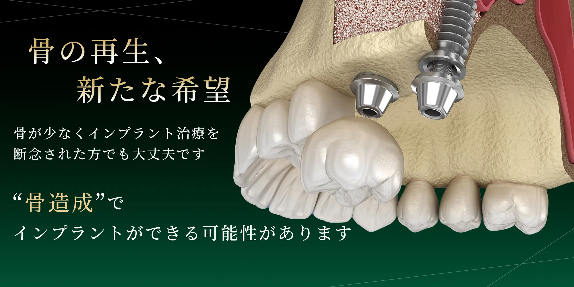 交野市 かたの村上歯科