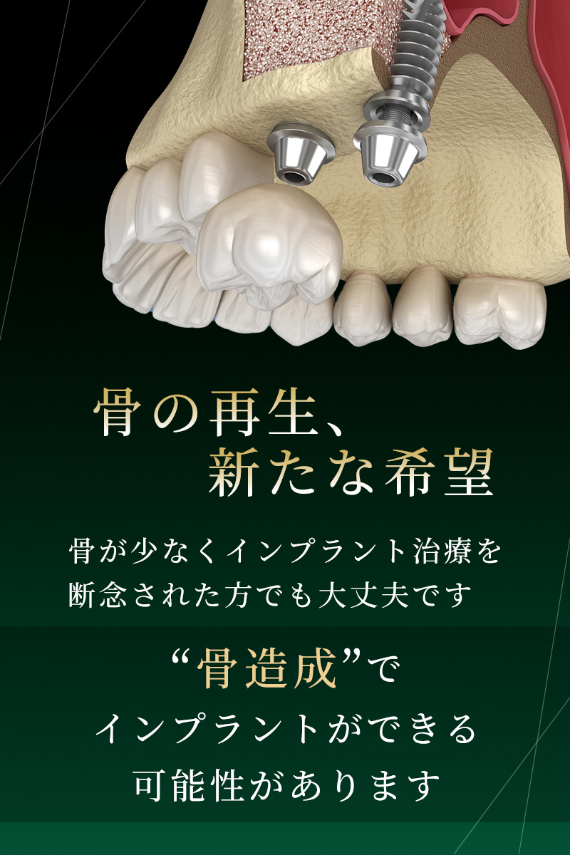 交野市 かたの村上歯科